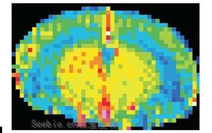 Nature Neuroscience：一种免疫蛋白可能诱发与高血压无关的痴呆