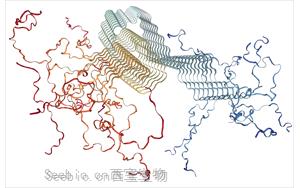 PNAS：一种新的检测方法有望早期发现帕金森病