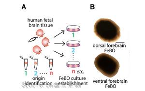 《Cell》新型组织衍生的<font color='red'>大脑</font>类器官可能会给<font color='red'>大脑</font>研究带来革命性的变化