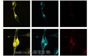 PNAS：脂肪酸调节脂质生物合成的新途径