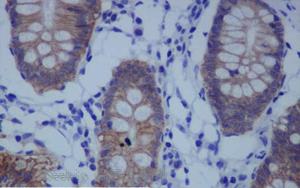 《PNAS》一种不为人知的蛋白质，它能保持人体细胞的健康