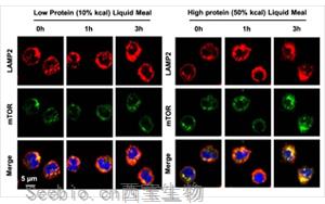 Nature子刊亮氨酸暴露实验证明高蛋白<font color='red'>饮食</font>如何使你的动脉硬化