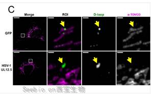 Nature子刊：细胞中的线粒体“泄漏”了，是如何让我们生病的