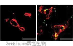 Nature子刊：肝脏中的免疫细胞会对高胆固醇水平做出反应，并吃掉多余的胆固醇