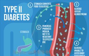 Nature Medicine：2型糖尿病的多祖先多基因<font color='red'>机制</font>