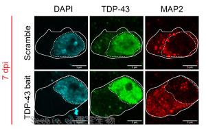 Cell Stem Cell：利用类<font color='red'>器官</font>保护痴呆和ALS中受到的脑损伤