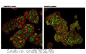 Nature最新发现控制CAR-T细胞寿命的<font color='red'>蛋白质</font>！