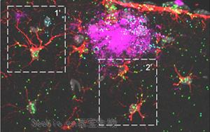 《Nature Neuroscience》可增强神经胶质细胞的<font color='red'>蛋白质</font>