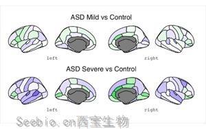 <font color='red'>自闭症</font>最早的生物学迹象