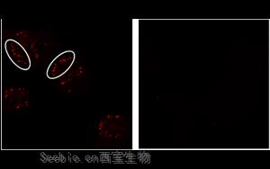突变蛋白在一些致命<font color='red'>癌症</font>中的新作用
