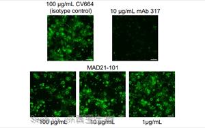 Science：一类全新的抗疟疾抗体