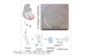 Nature Cardiovascular Research：心脏炎症的关键差异