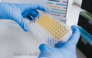 免疫技术新视界：层析、印迹、吸附与比浊的前沿碰撞