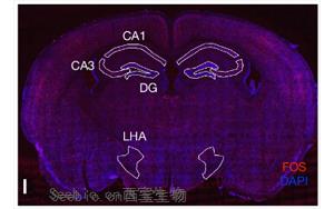 Nature：科学家发现记忆如何控制新陈代谢