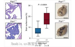 干扰素-r（IFNr）调控软脑膜抗肿瘤免疫应答的机制研究
