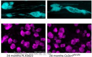 《Nature Neuroscience》大脑白质为何随年龄退化？因为<font color='red'>免疫细胞</font>“勾心斗角”