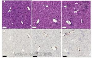 CD4+ T细胞通过激活库普弗细胞分泌IL-27逆转<font color='red'>HBV</font>诱导的CD8+ T细胞功能障碍的机制研究