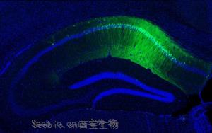 5-羟色胺(<font color='red'>5-HT</font>)通过调节肠道菌群-免疫轴改善加速度暴露诱导的大鼠肠脑轴功能障碍及认知损伤