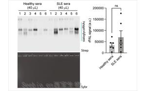 RNA N-糖基化通过<font color='red'>免疫</font>逃逸和稳态胞葬作用维持<font color='red'>免疫</font>平衡的分子机制