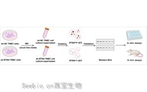 靶向小细胞外囊泡中<font color='red'>网状蛋白4</font>(RTN4)抑制三阴性乳腺癌转移并增强免疫治疗效果的机制研究