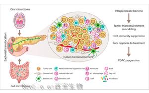 JAMA Oncology：口腔微生物群与胰腺癌风险相关