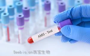 抗缪勒管激素（AMH）-磁微粒化学发光法（AE/AP） +荧光免疫层析解决方案