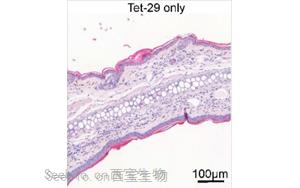 Science Signaling：深入了解糖类如何调节炎症性<font color='red'>疾病</font>过程