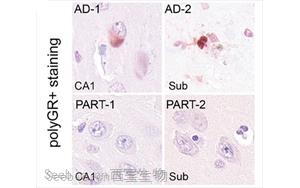 阿尔茨海默病新病理机制：polyGR蛋白聚集物关联Aβ斑块与pTau缠结并受氧化应激调控