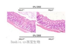 一文读懂DSS在动物结肠炎模型构建中的应用 一文读懂DSS在动物结肠炎模型构建中的应用