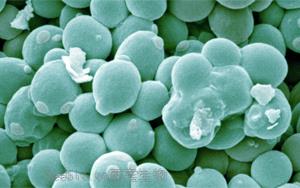 工程化产丁酸酵母通过协同作用改善阿尔茨海默病相关表型