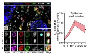 组织适应性<font color='red'>Treg</font>细胞通过整合炎症信号(IFN-γ/IL-10)激活mTORC1/Myc通路促进治疗相关肠道损伤修复的新机制 组织适应性<font color='red'>Treg</font>细胞通过整合炎症信号(IFN-γ/IL-10)激活mTORC1/Myc通路促进治疗相关肠道损伤修复的新机制