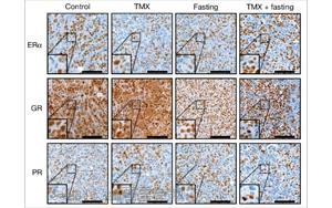 <font color='red'>禁食</font>通过激活糖皮质激素来提高乳腺癌治疗的疗效